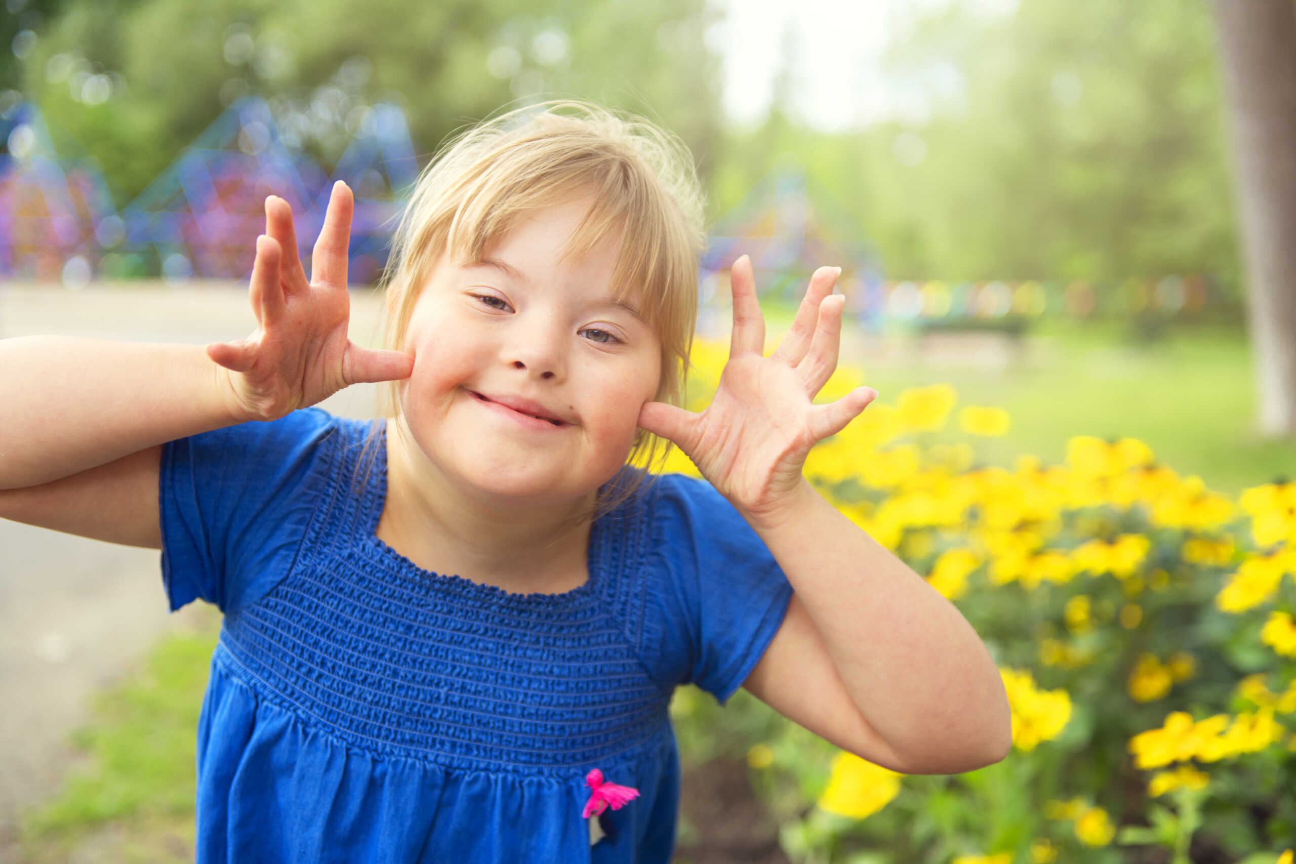 Down Syndrome